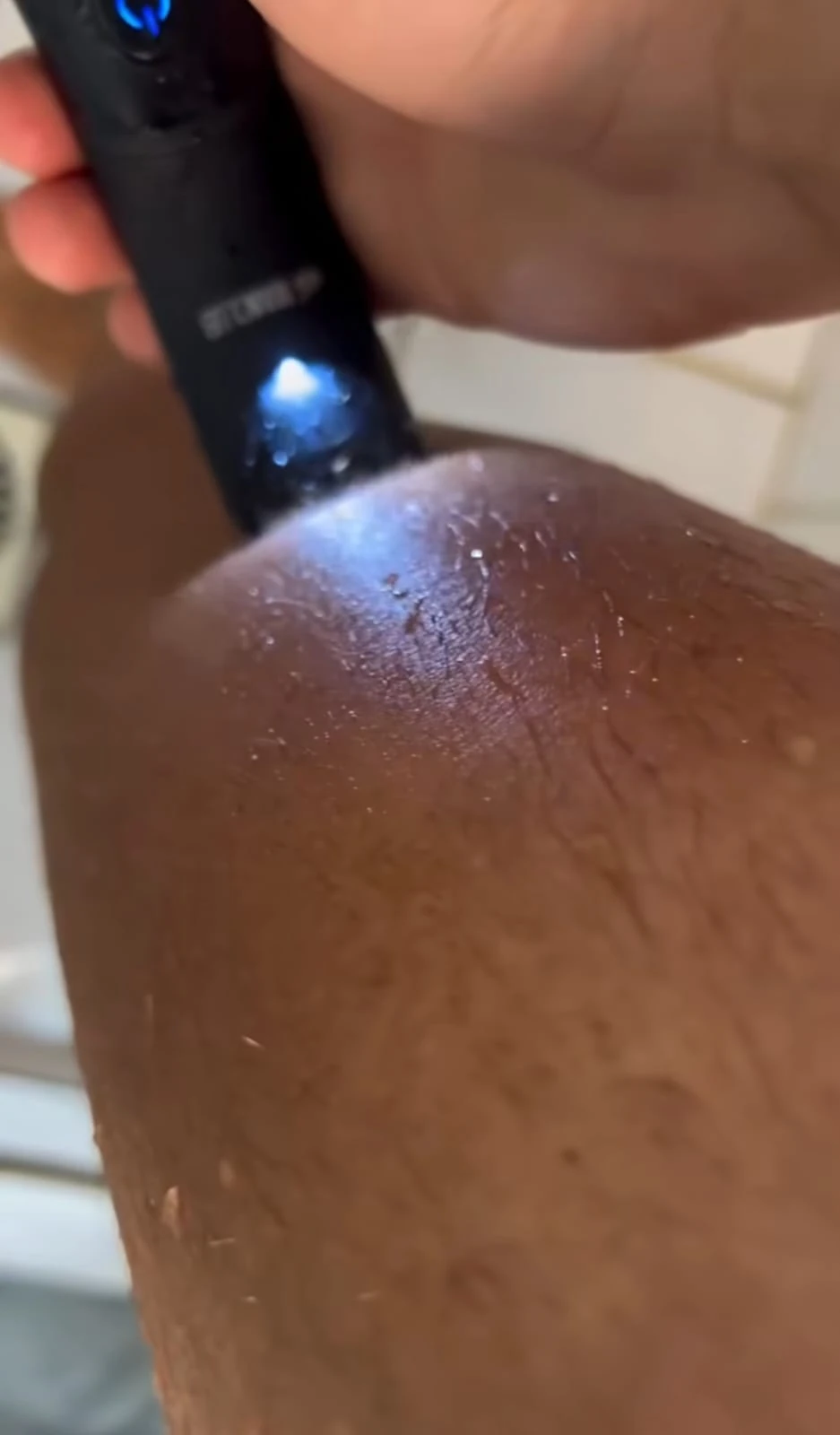Aparação Mecânica de Pelos (Higiene Esportiva)